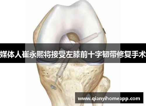 媒体人崔永熙将接受左膝前十字韧带修复手术